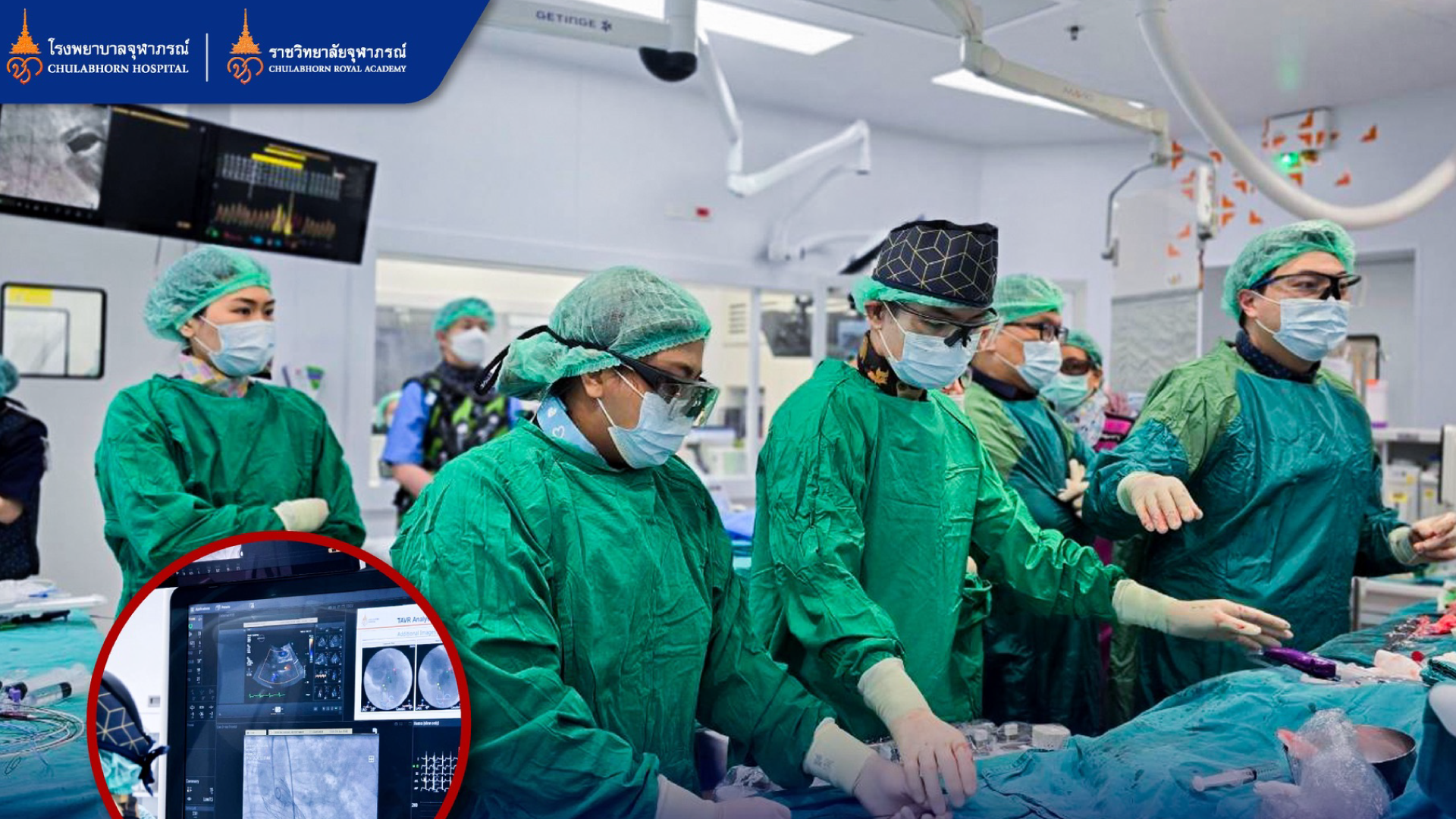 ความสำเร็จเปลี่ยนลิ้นหัวใจเอออร์ติกผ่านสายสวน ครบ 200 ราย 